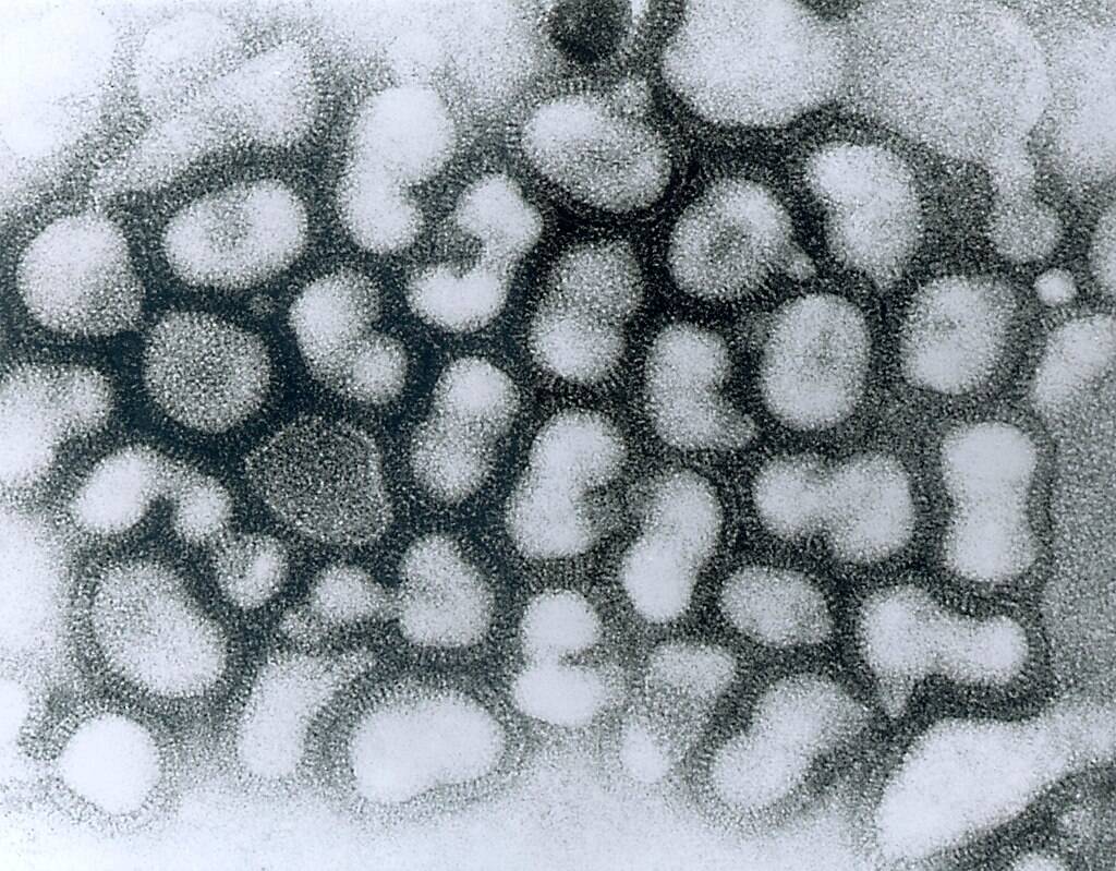 Transmission electron micrograph of influenza A virus, late passage...CDC/Dr. Erskine Palmer, 1981